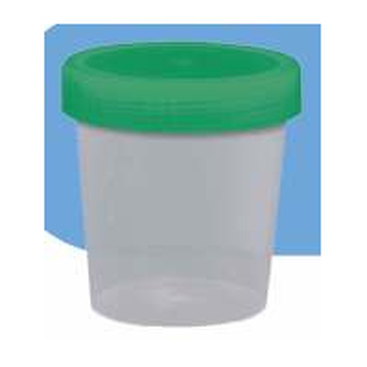 Urine cup with screw lid